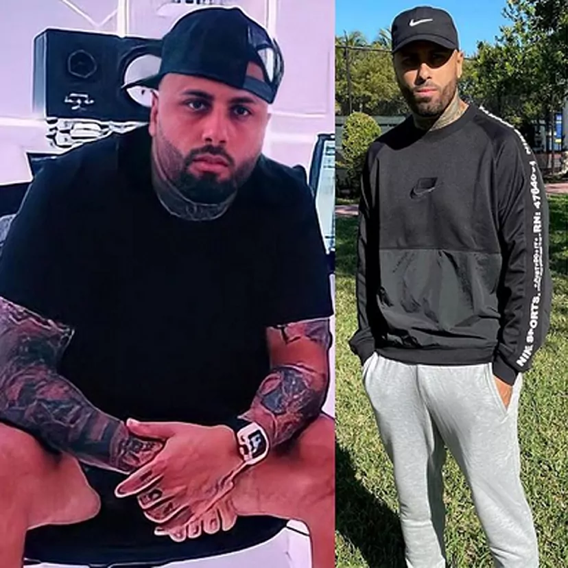 La Transformación de Nicky Jam İberia Clinic